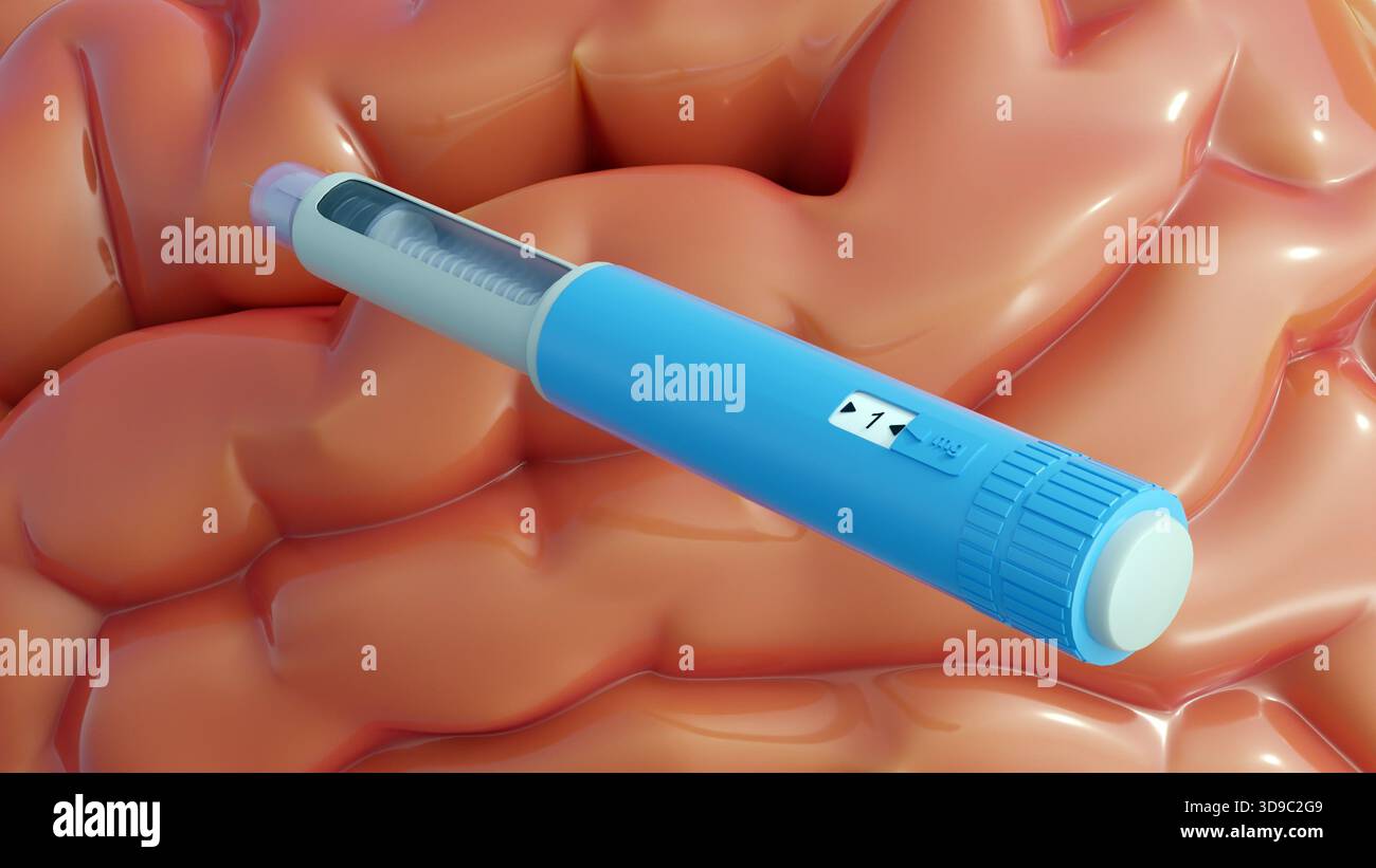 Rendering 3d del cervello e delle penne dell'iniettore. Gli effetti neurologici o cognitivi del farmaco GLP-1. Foto Stock