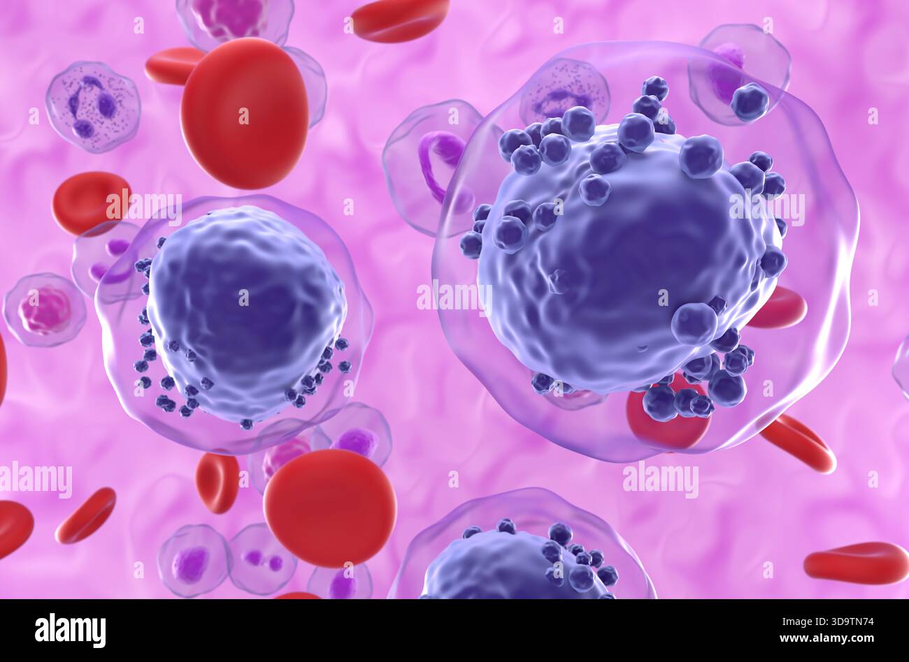 Leucemia mieloide acuta (LMA) nel flusso sanguigno - vista semi-primo piano illustrazione 3d. Foto Stock