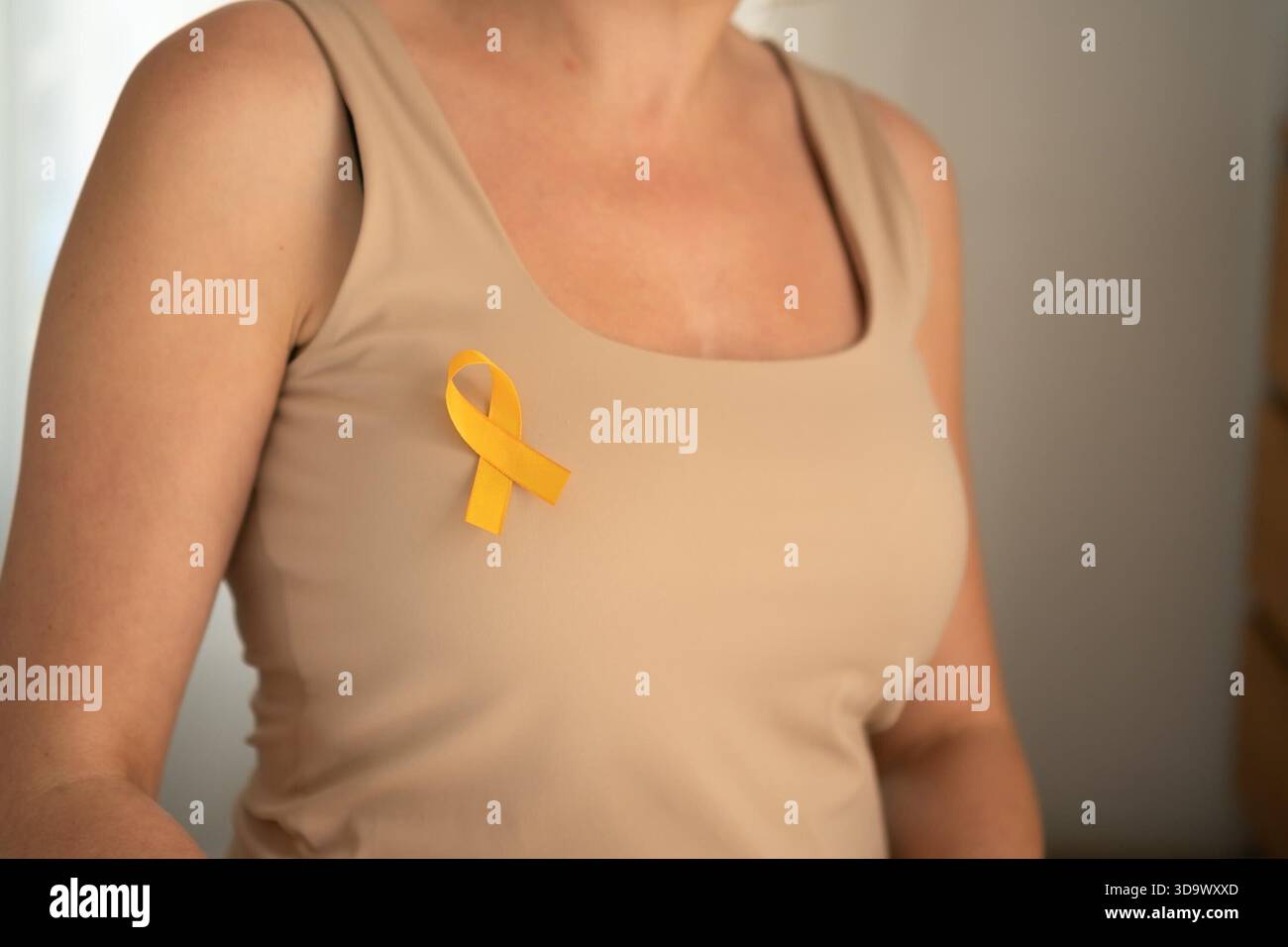 Primo piano del nastro giallo di sensibilizzazione in raso sull'abbigliamento, che rappresenta la compassione e la solidarietà con le famiglie di cancro pediatrico. || modello rilasciato Foto Stock