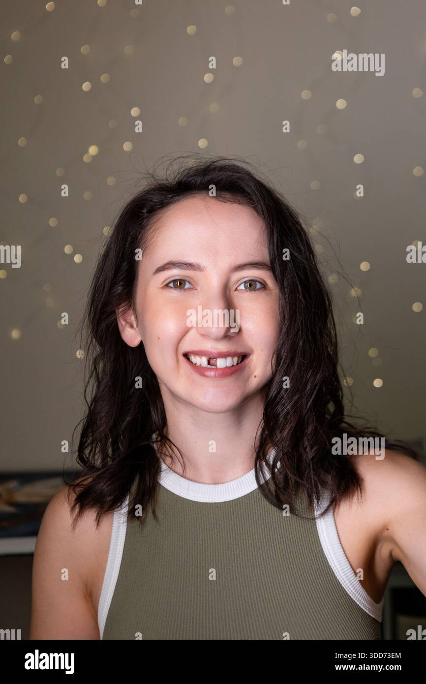 Donna senza denti senza un dente anteriore. Donna adulta emotiva da sola. Allentare l'emozione dei denti per il contenuto delle procedure odontoiatriche. Foto Stock