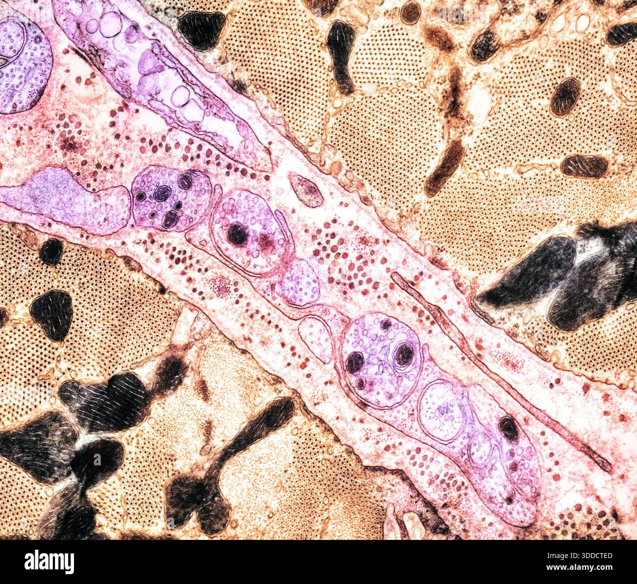 Muscolo cardiaco, TEM, sotto il microscopio Foto Stock