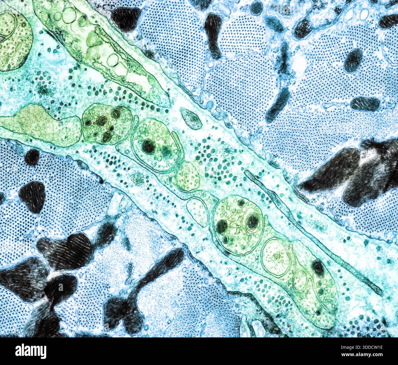 Muscolo cardiaco, TEM, sotto il microscopio Foto Stock