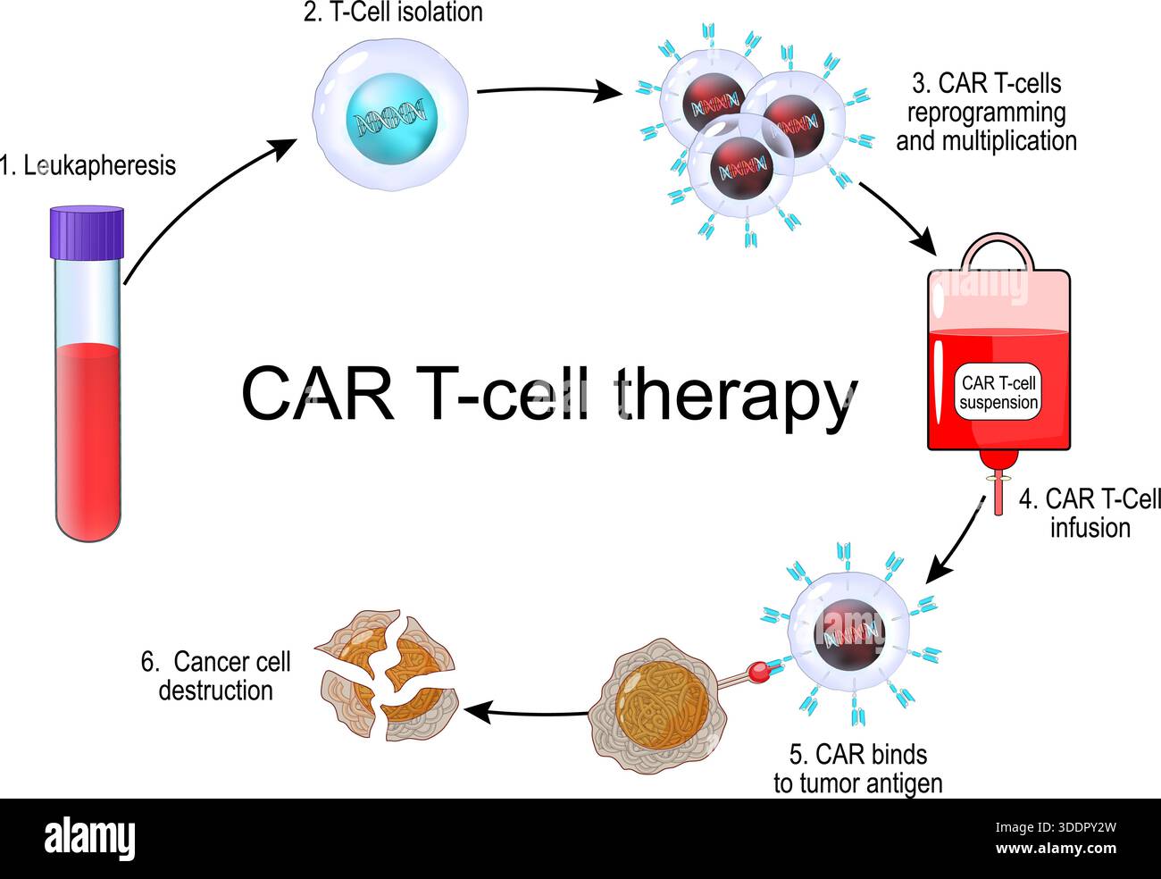 Terapia con cellule T DELL'AUTO. Immunoterapia contro il cancro. Cellula CAR-T per uccidere il tumore. Medicina personalizzata. Illustrazione vettoriale Illustrazione Vettoriale