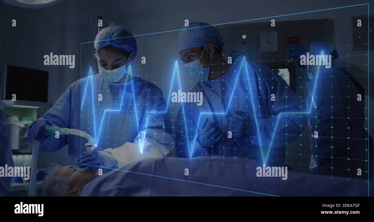 Gestione dei medici delle vie aeree che indossano abiti blu, maschere in SALA OPERATORIA, che trattengono il tubo di ventilazione, sovrapposizione ECG Foto Stock