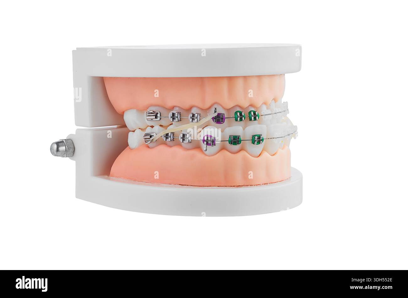Modello ortodontico dentale con bretelle che mostrano staffe, fili e allineamento per lo studio Foto Stock