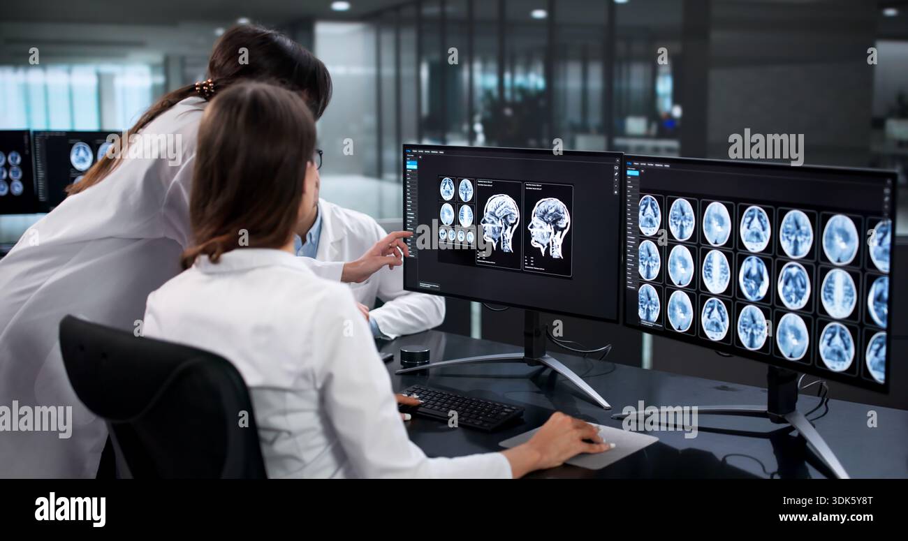 Neurologi qualificati analizzano attentamente le scansioni cerebrali per diagnosticare lesioni. Foto Stock