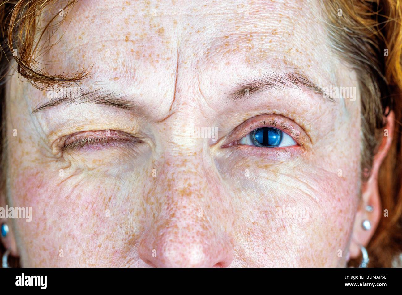 Ritratto ravvicinato di una donna anziana con un occhio chiuso e un occhio blu aperto, che mostra la consistenza naturale della pelle e le lentiggini. Foto Stock