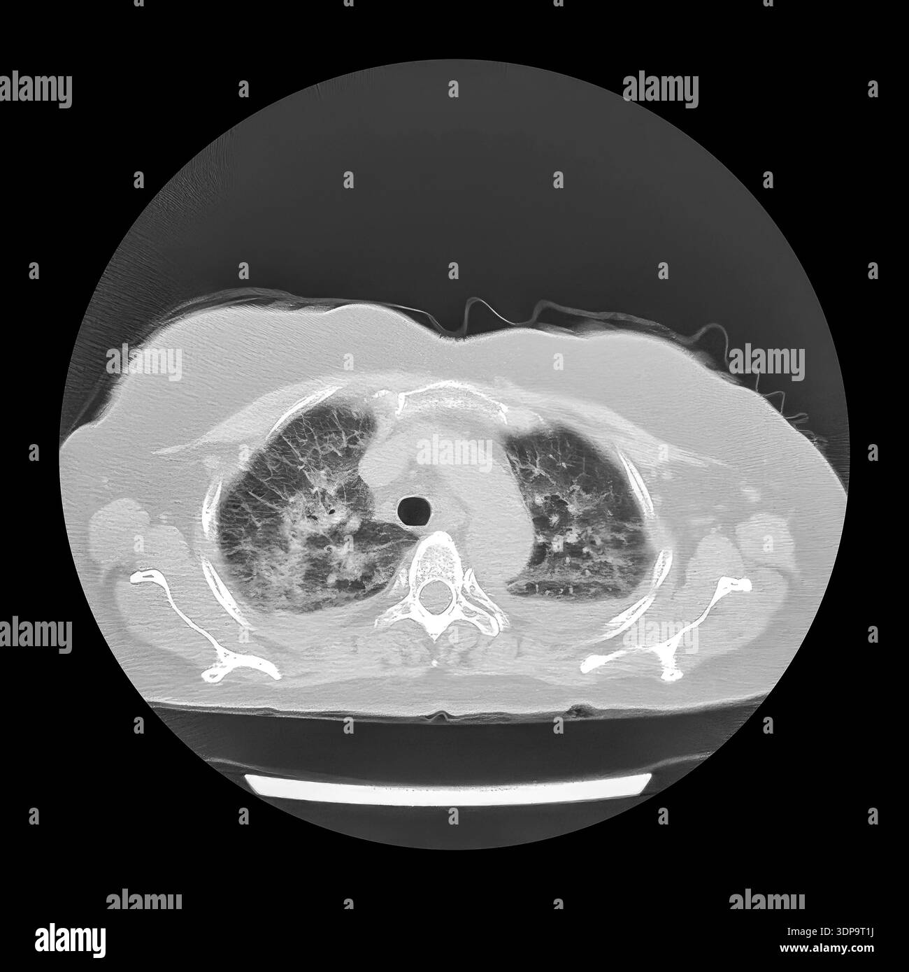 liquido interstiziale e plasma Fisiologia della Respirazione main image 1