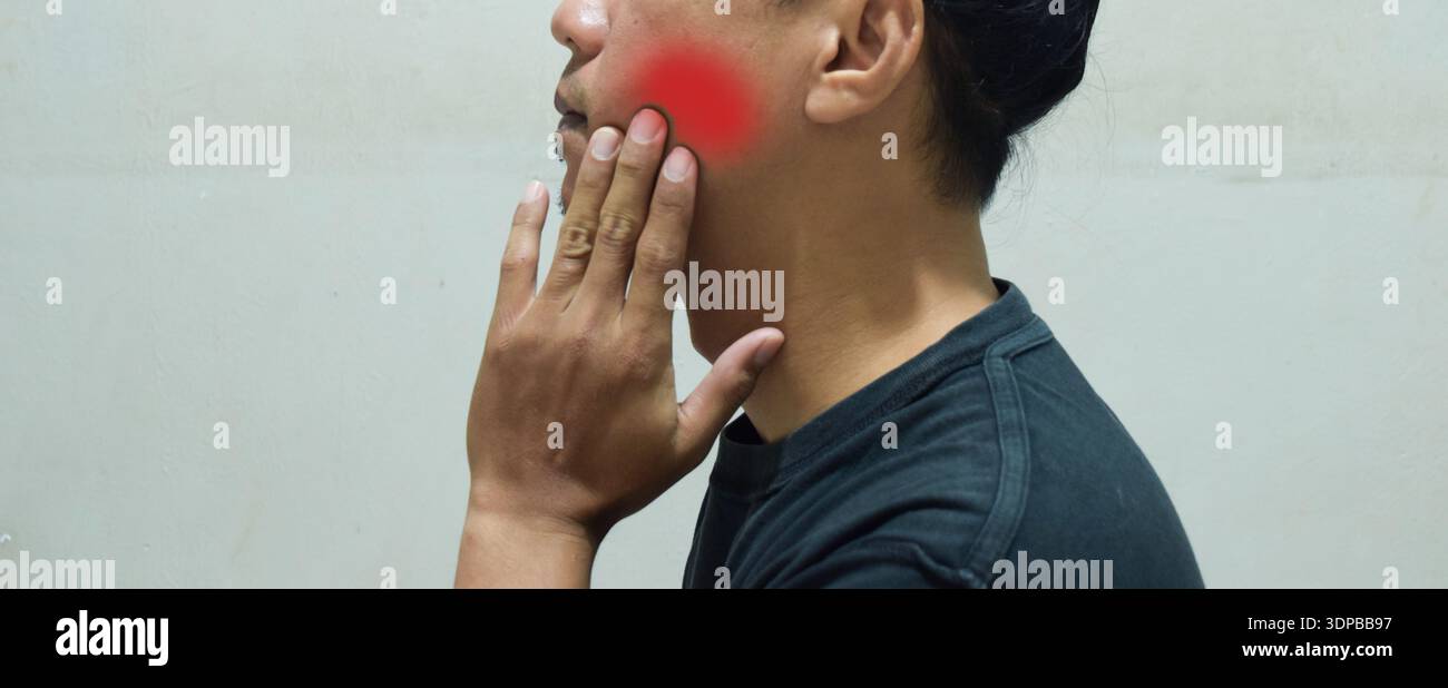 uomo con mal di denti, malattia parodontale nei denti di saggezza. Concetto di problemi di salute Foto Stock