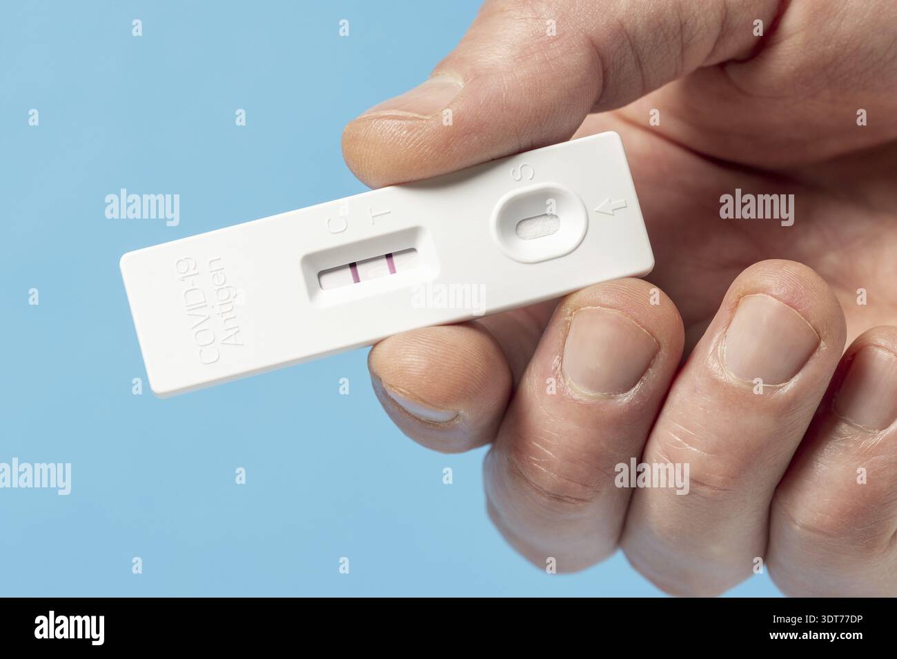 Mano che mostra il risultato positivo del test per Covid-19 con il kit per il test antigene rapido SARS CoV-2 (ATK). Concetto di protezione infettiva da coronavirus Foto Stock