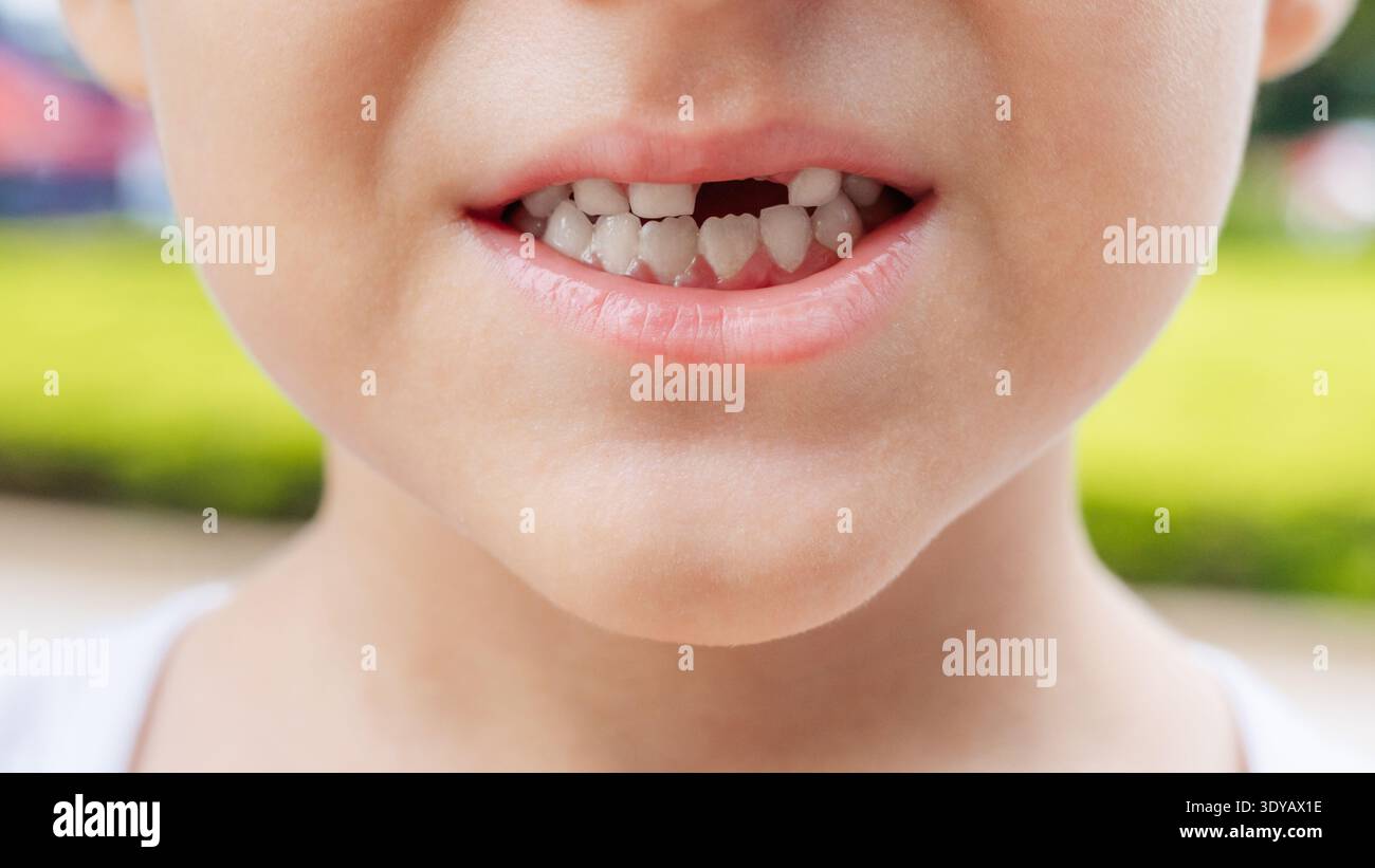 Primo piano di un bambino sorridente che mostra un vuoto dopo aver perso un dente di latte. Foto Stock