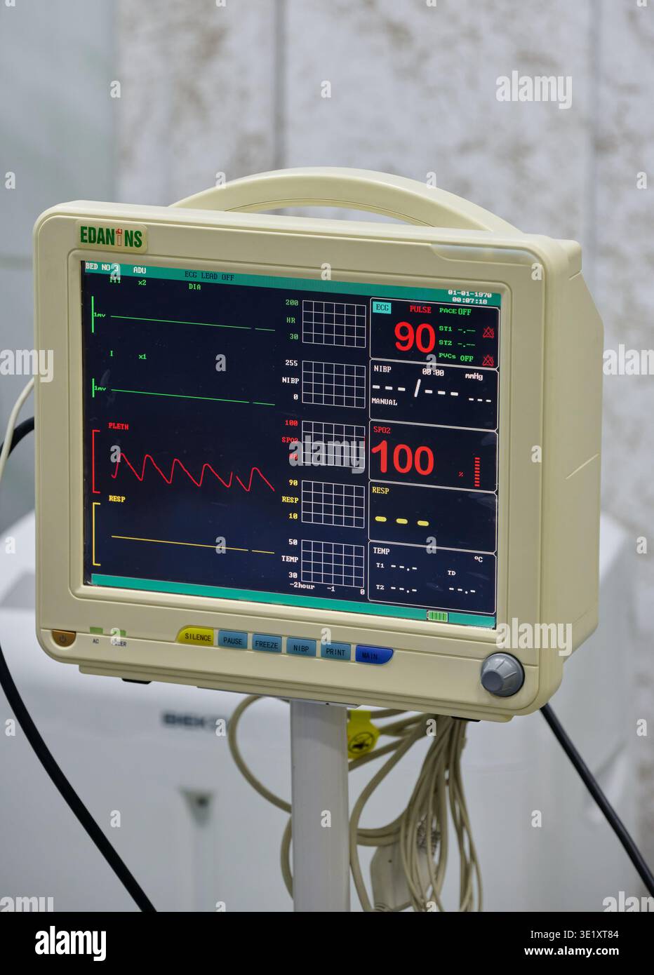 Monitor paziente ospedaliero che visualizza ECG, polso e saturazione di ossigeno durante l'intervento chirurgico o la terapia intensiva, apparecchiature di monitoraggio medico in clinica. Foto Stock