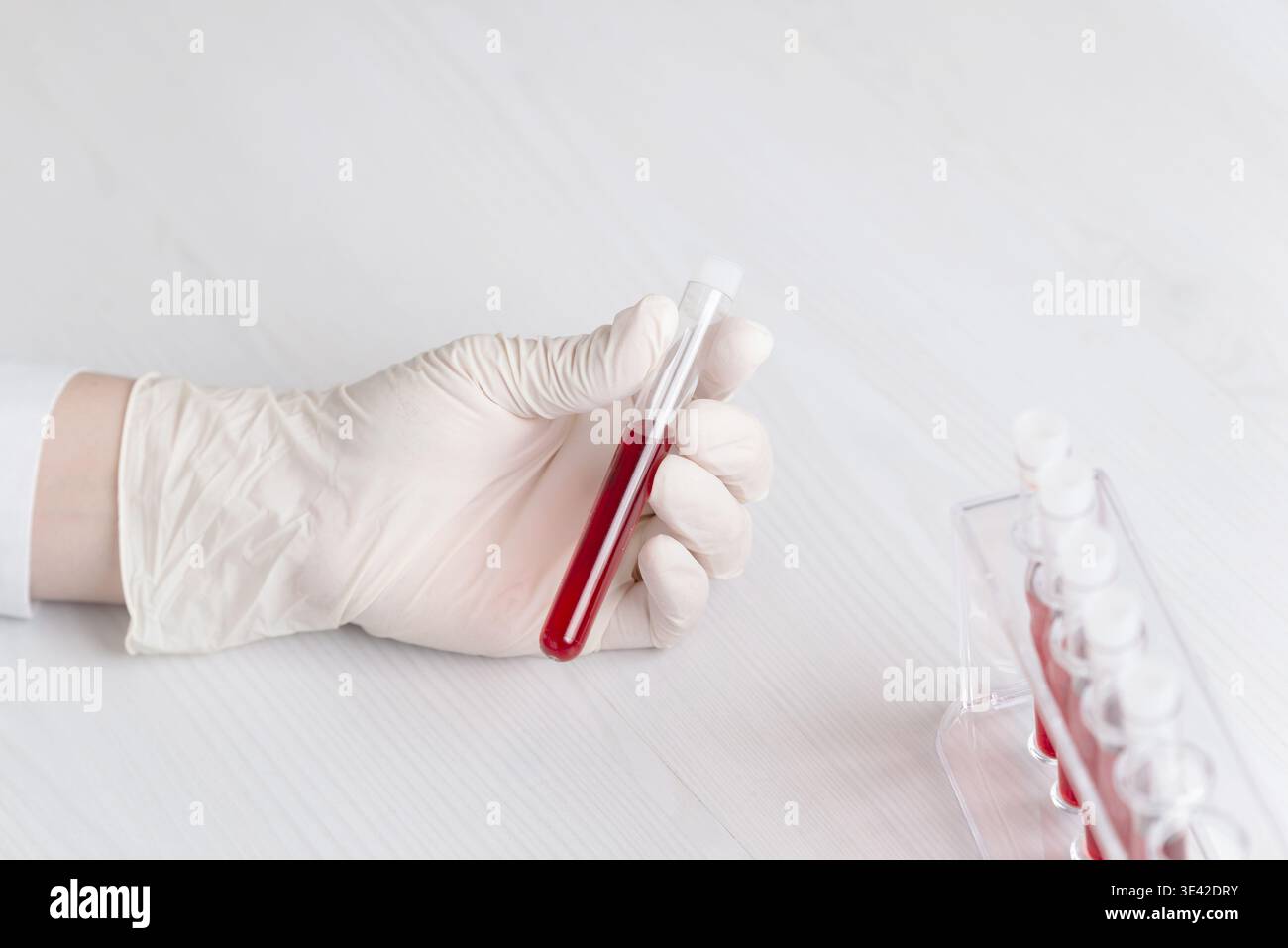 Mani con guanti per provette riempite di sangue su superfici pulite, ricerca di laboratorio e analisi mediche con background minimo Foto Stock