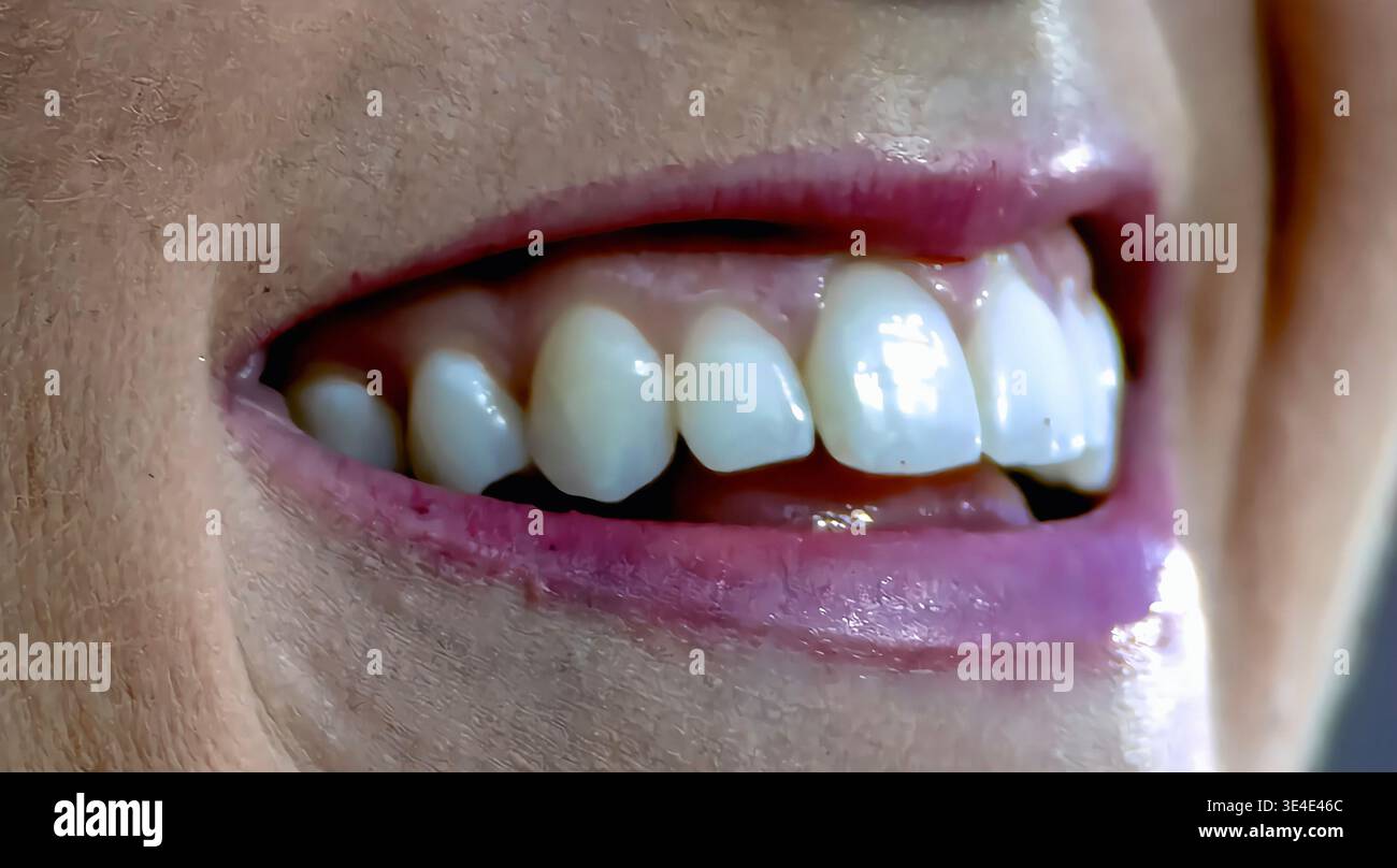 Una vista molto ravvicinata dei denti bianchi puliti Foto Stock