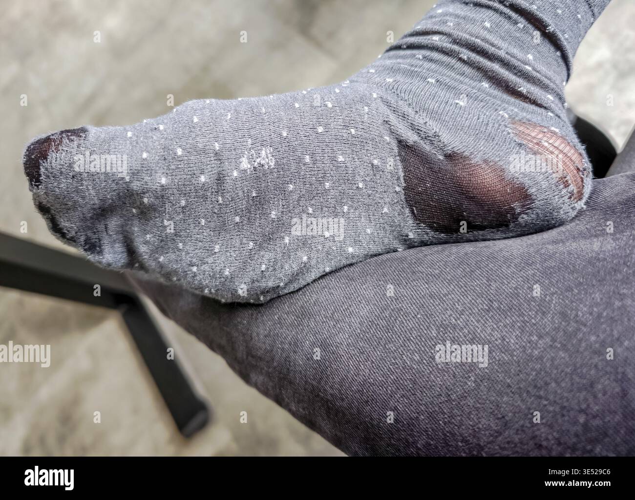 Calzino consumato sul piede di mans, primo piano di tessuti e buchi danneggiati, dettagli della vita quotidiana che mostrano l'usura dell'abbigliamento e il concetto di igiene. Povero uomo Foto Stock