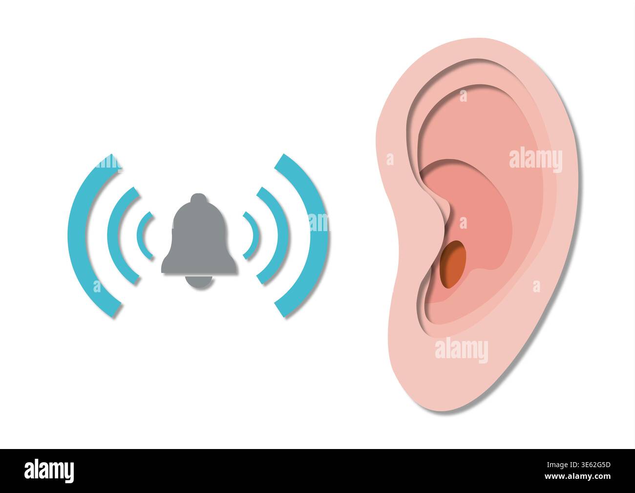 Tinnito, illustrazione concettuale. Foto Stock