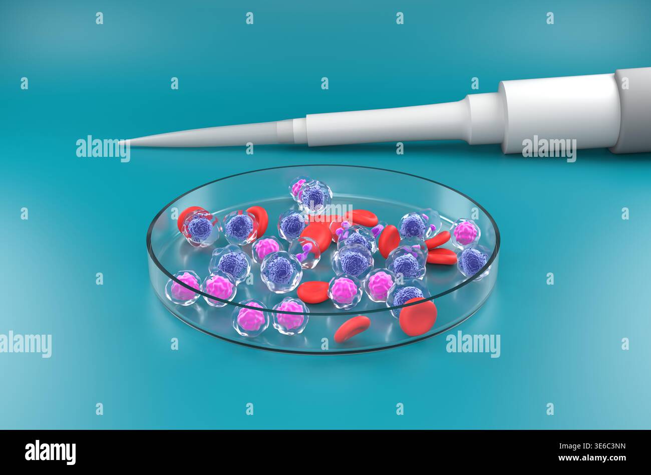 Leucemia mieloide acuta (AML) - Vista isometrica illustrazione 3d. Foto Stock