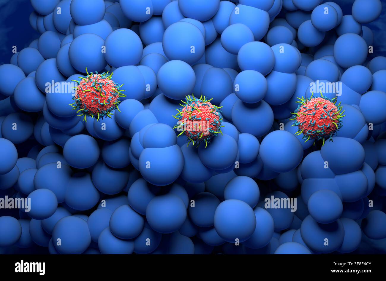 Terapia con cellule T dell'automobile in Glioblastoma multiforme - Vista isometrica illustrazione 3d. Foto Stock