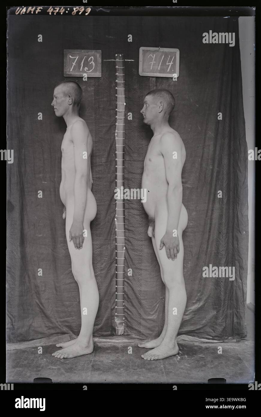 L'immagine è una fotografia antropologica storica dell'inizio del XX secolo, che documenta le teorie antropologiche dell'epoca. I ricercatori in Estonia credevano che gli uomini estoni avessero cavità toraciche strette e fianchi larghi. Questa immagine fa parte della collezione medica storica del Museo dell'Università di Tartu. Foto Stock