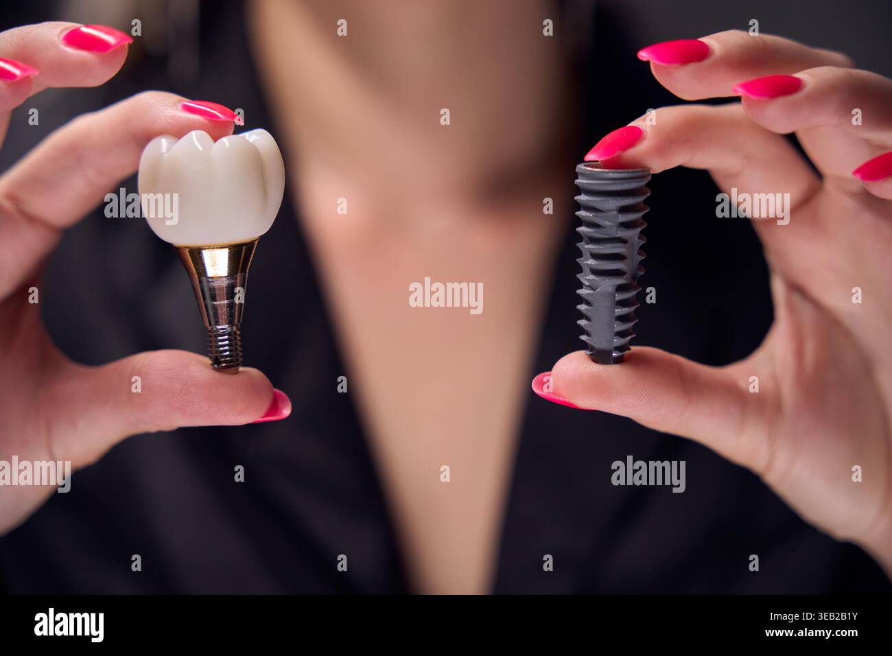 Primo piano della corona dentale e dell'impianto di illuminazione da studio Foto Stock