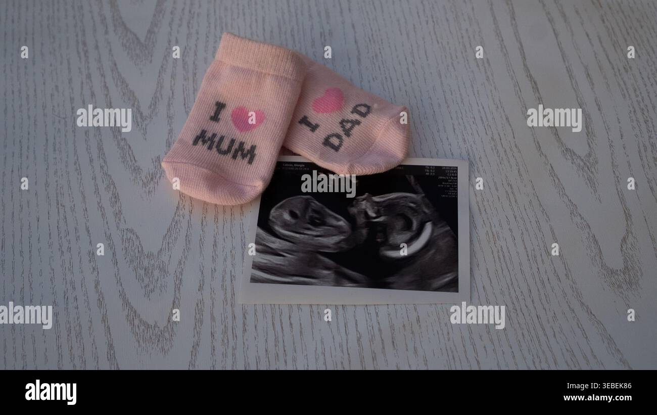 Annuncio di gravidanza con calzini per bambini amo mamma papà e sonogramma Foto Stock
