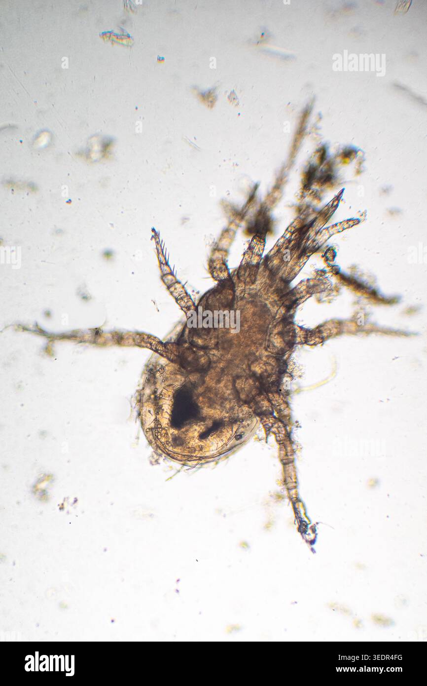 Campione di acaro del suolo da un campione di terreno o di detriti organici. Piccolo aracnide, adatto per concetti relativi all'ecologia del suolo, alla biodiversità, alla decomposizione Foto Stock