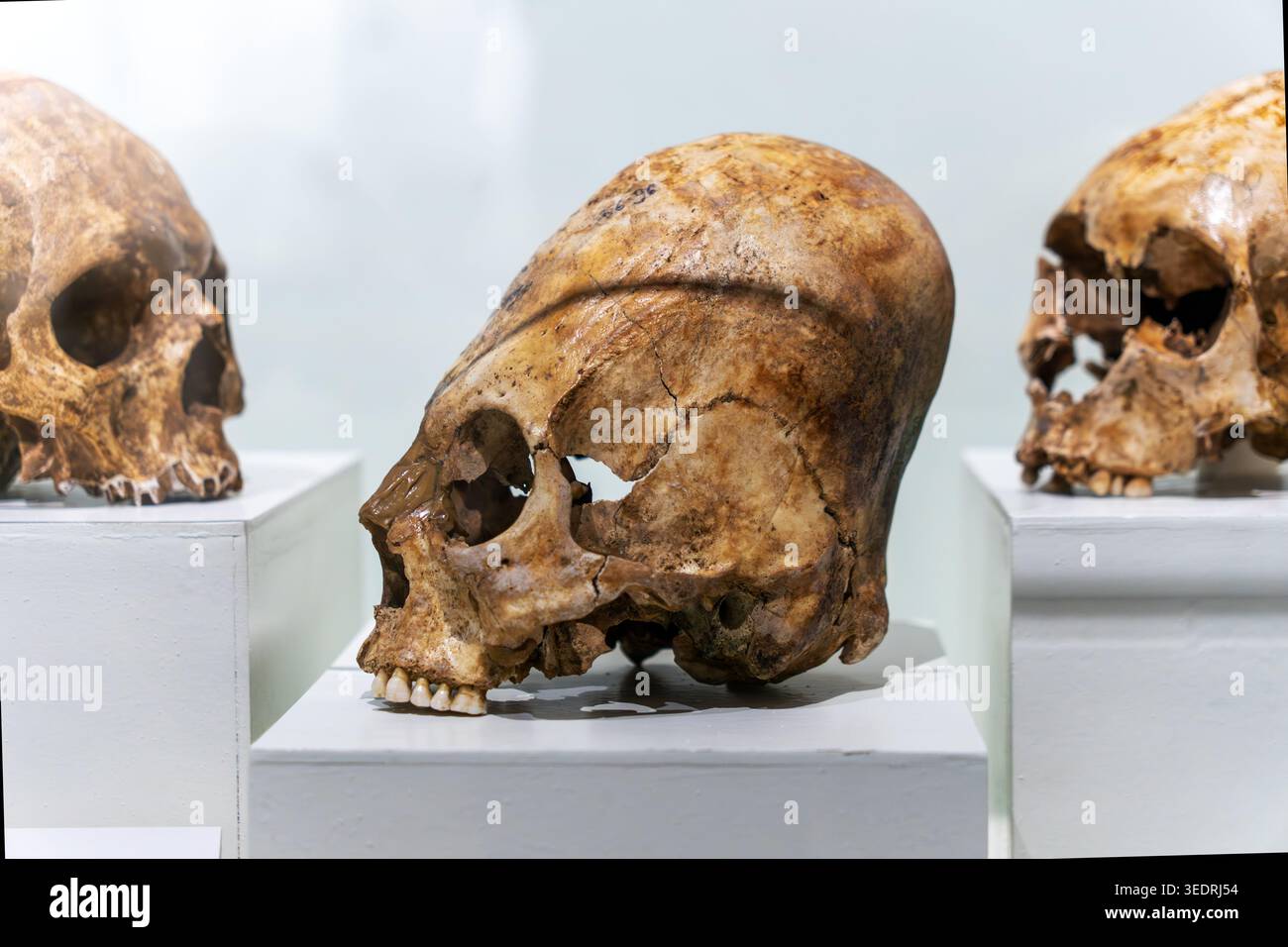 teschi umani allungati su sfondo bianco. Struttura ossea visibile. Deformazione cranica artificiale. Antichi manufatti funerari. Foto Stock