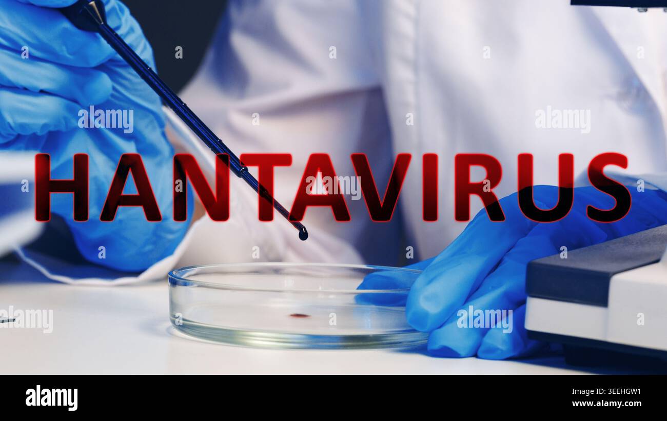Ricerca sull'hantavirus in un laboratorio con particolare attenzione alle tecniche di microbiologia Foto Stock