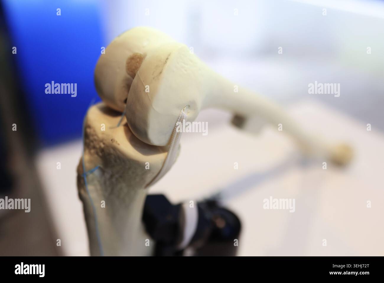 Primo piano del modello ortopedico articolare del ginocchio utilizzato per l'educazione medica, la pianificazione chirurgica e la presentazione dei moderni metodi di trattamento articolare. Foto Stock
