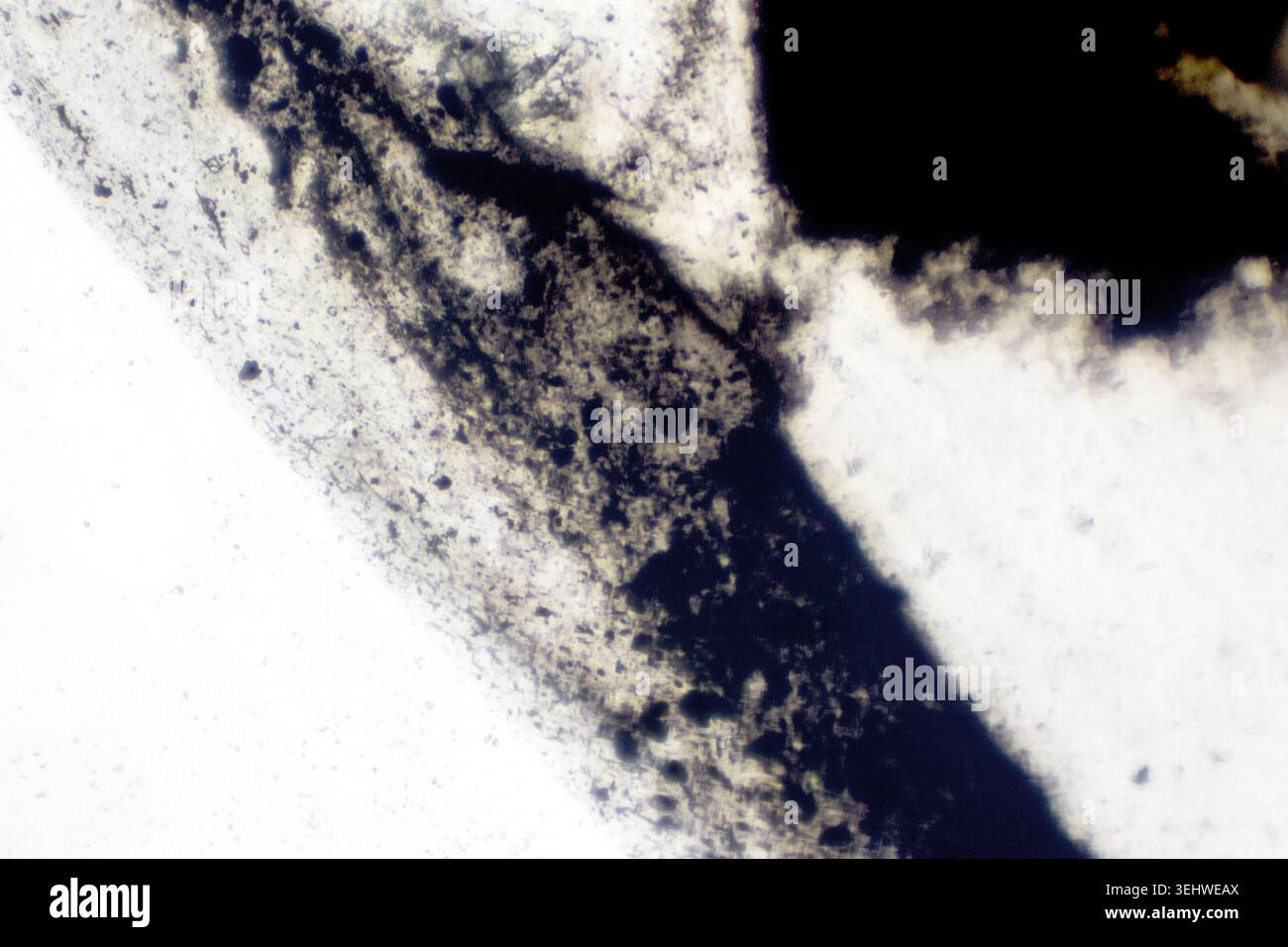 sacco d'inchiostro in un calamaro visto sotto un microscopio leggero con incrementi di 10 volte Foto Stock