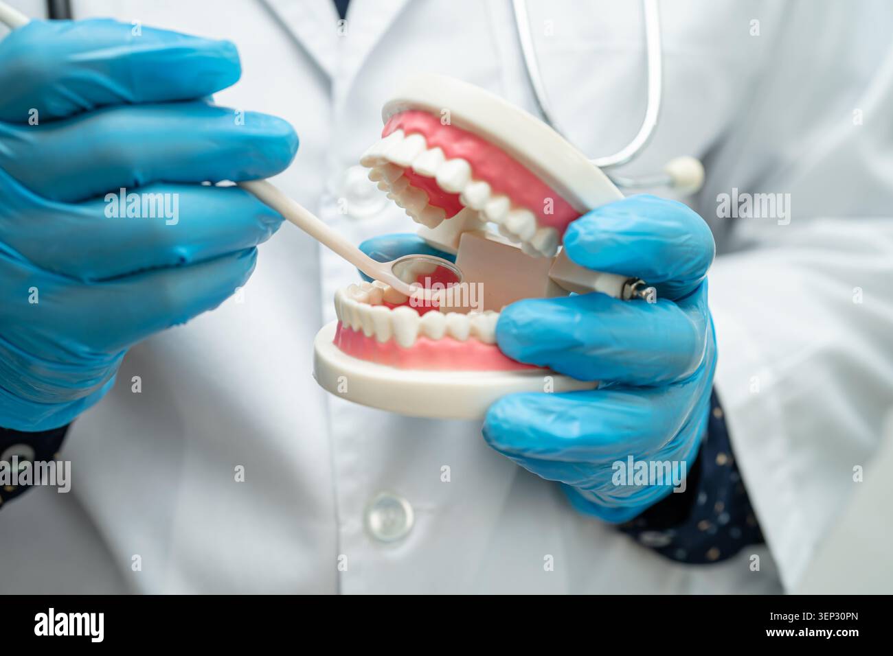 Dentatura, dentista che tiene il modello dentale dei denti per studiare e trattare in ospedale. Foto Stock