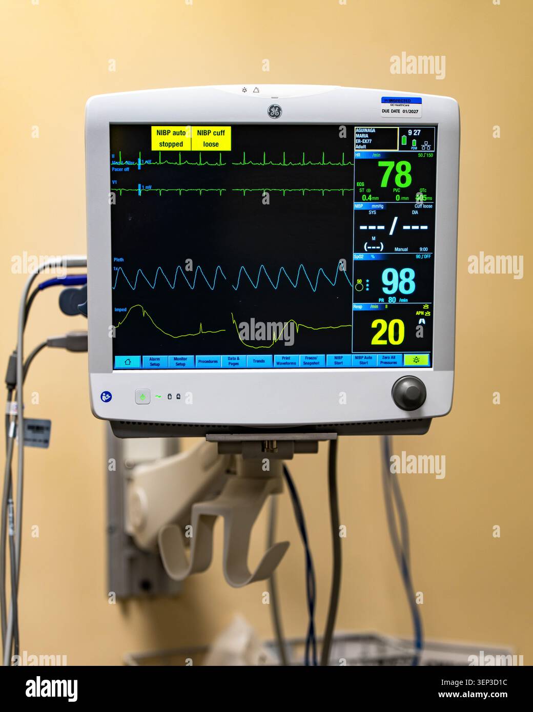 Monitor paziente ospedaliero che visualizza i parametri vitali, la frequenza cardiaca, il livello di ossigeno e i dati respiratori in ambito clinico Foto Stock