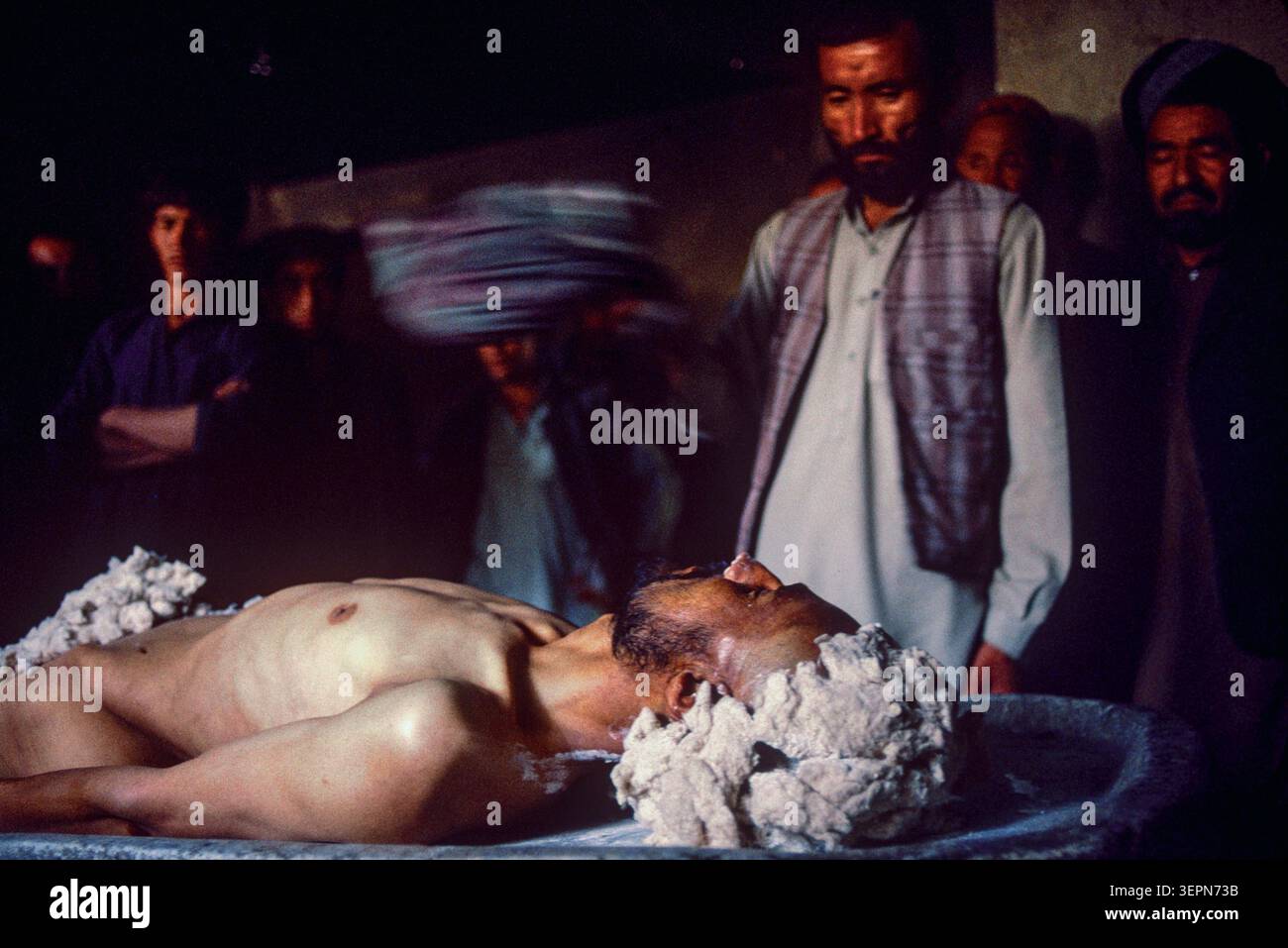KABUL, UN UOMO DI NURISTAN VENUTO NELLA CAPITALE PER CONTROLLARE LA SUA FAMIGLIA, E' STATO COLPITO ALLA TESTA DAI SACCHEGGIATORI DURANTE UNA BATTAGLIA DI STRADA., 1992 Foto Stock