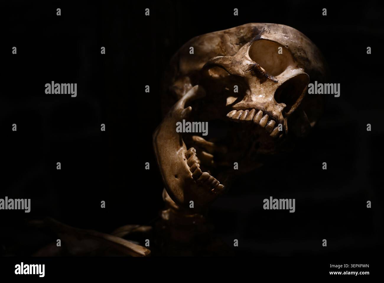 Un cranio umano con la bocca aperta nel dolore dopo essere stato bruciato al rogo Foto Stock