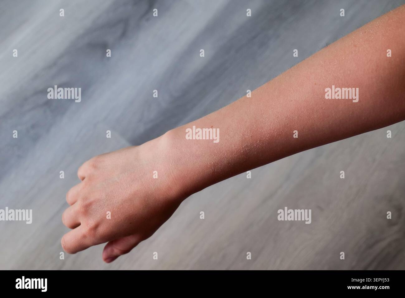 Peeling a secco a mano, primo piano Foto Stock