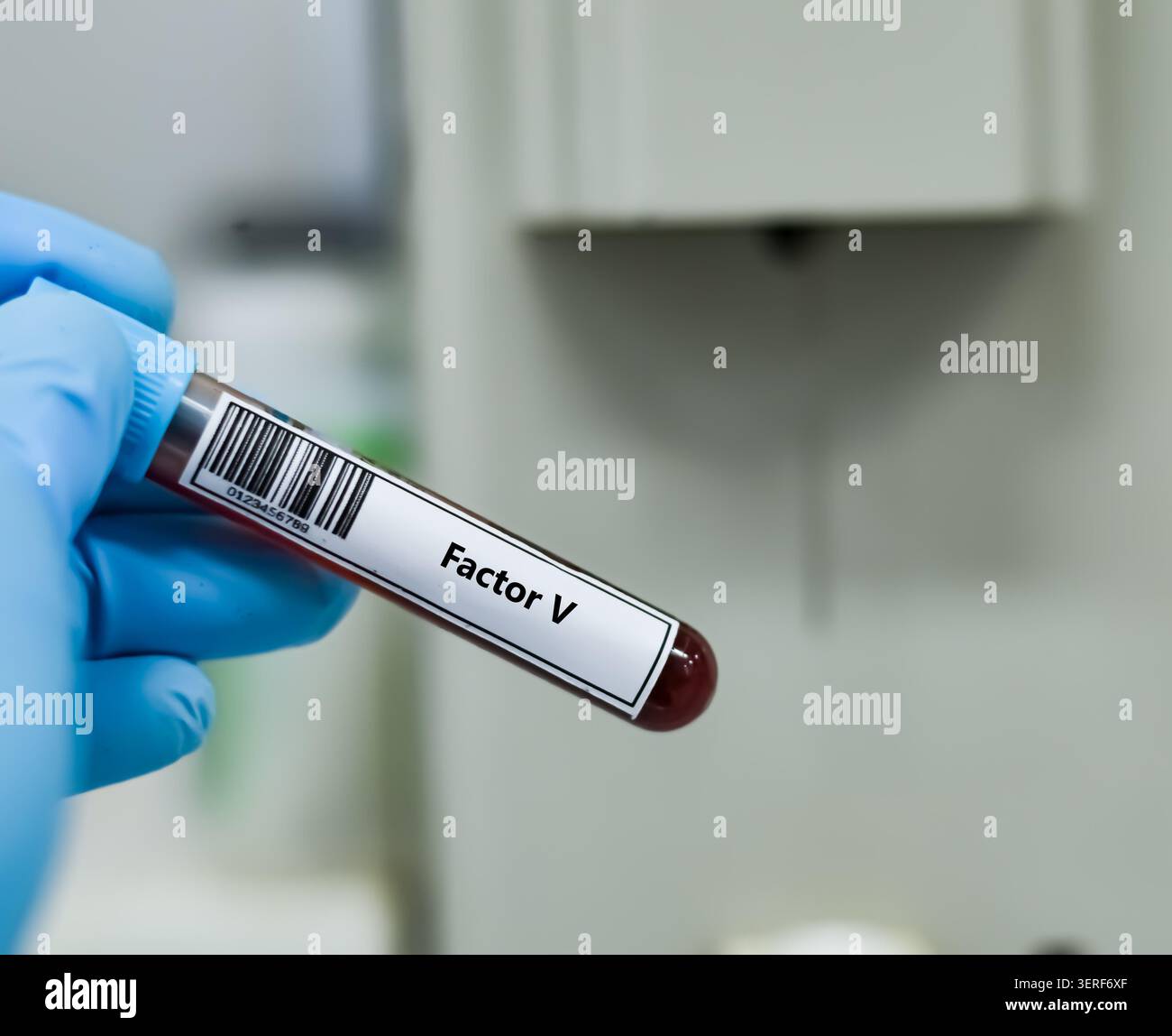 Provetta per campione di sangue per analisi del fattore V. Foto Stock