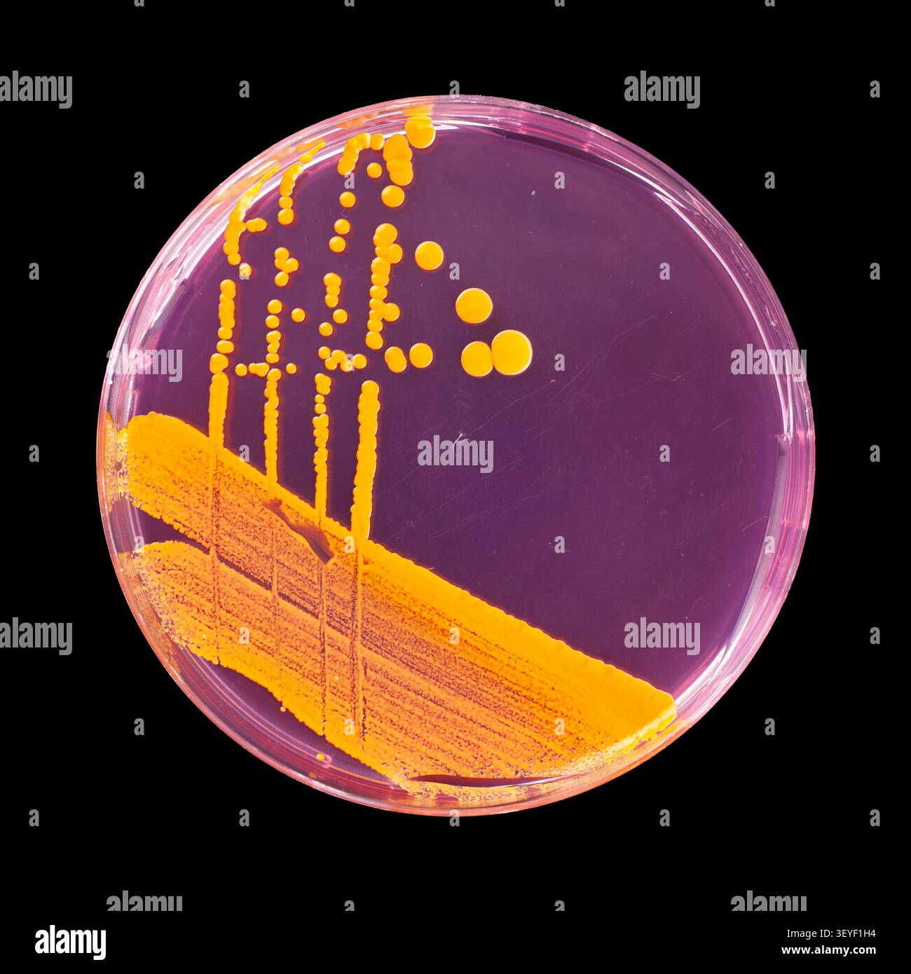 Coltura pura del ceppo Staphylococcus aureus su capsula di Petri Mannitol Salt Agar (MSA) (identificata da MAIDI TOF) Foto Stock