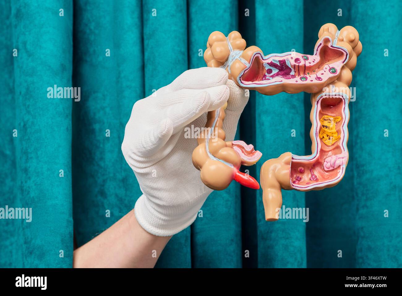 Visualizzazione della patologia del sistema digerente e della mucosa intestinale davanti a una tenda. Valutazione della salute del tratto digerente e sollievo dalla stitichezza. Foto Stock