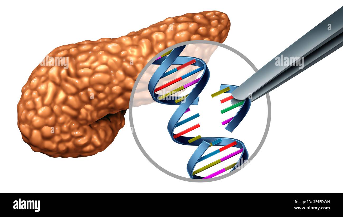 Concetto di genetica del diabete che mostra insulina mal piegata nelle cellule beta del pancreas che causa stress cellulare e riduzione della produzione di insulina come ricerca medica Foto Stock