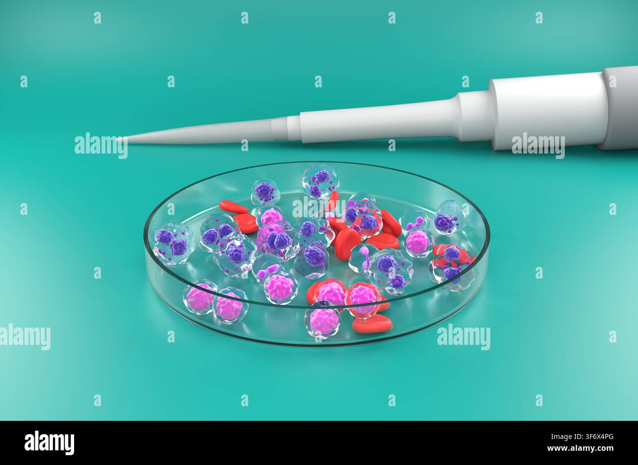 Cellule di mieloma multiplo (MM) – illustrazione isometrica 3D Foto Stock