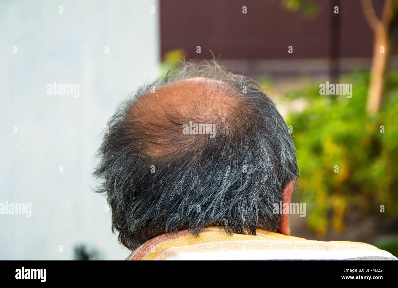 Vista posteriore di un uomo anziano con capelli grigi diradati e una calvizie sulla testa all'aperto. Concetto di calvizie maschile, alopecia androgenetica Foto Stock