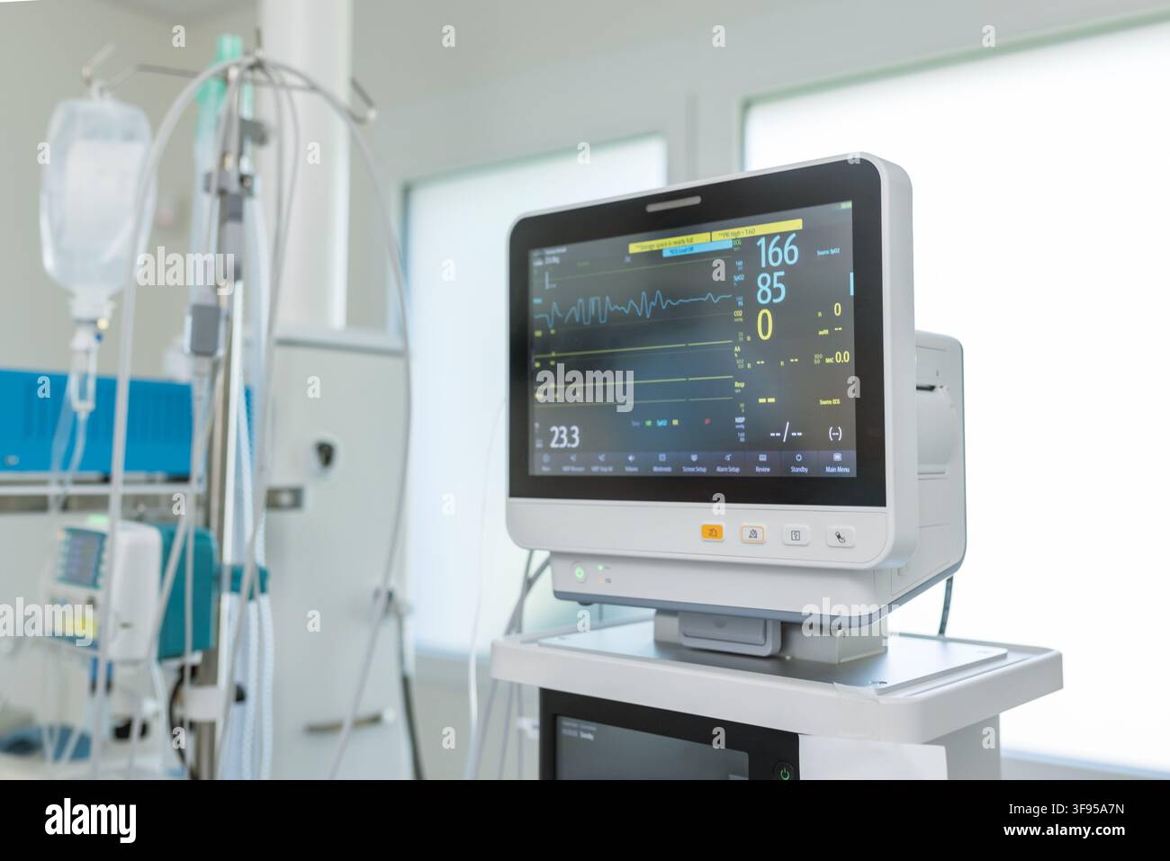 Una sala operatoria ospedaliera mostra attrezzature mediche, incluso un monitor che visualizza i dati del paziente. La sala è attrezzata per interventi chirurgici. Foto Stock