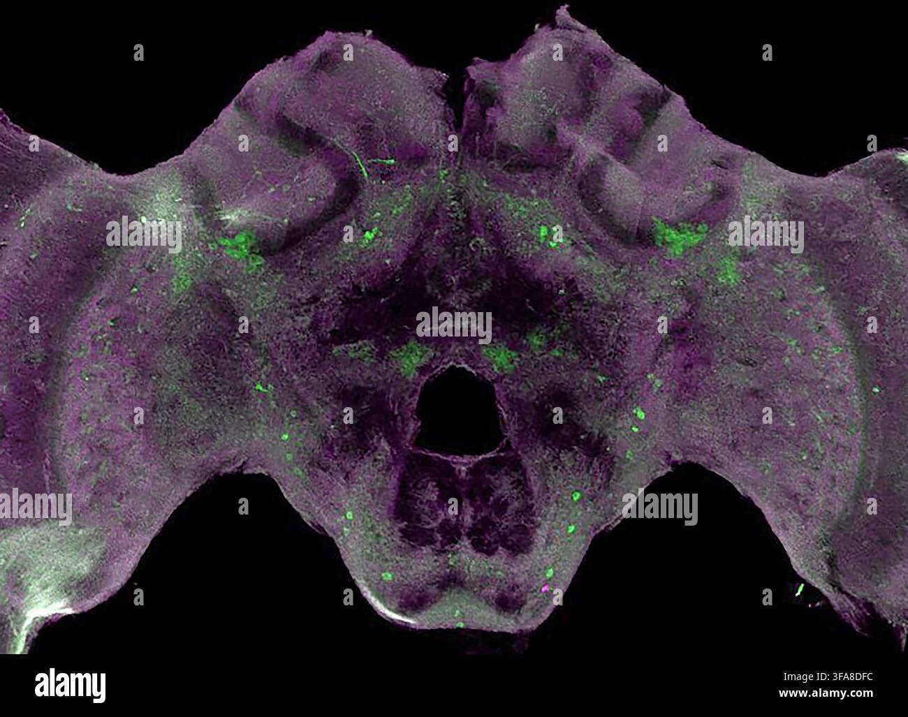 Cervello di ape mellifera. I cervelli degli insetti differiscono nella forma da quelli umani ma condividono geni e neurochimici simili. In questa immagine di microscopia confocale, le macchie verde brillante mostrano la tirosina idrossilasi, un enzima cruciale per la produzione di dopamina. La dopamina è coinvolta in funzioni chiave come il provare piacere. Una versione ottimizzata e migliorata di un'immagine NIAID/NIH. Crediti: M. McNeill, Robinson Lab, Università dell'Illinois a Urbana-Champaign. Foto Stock