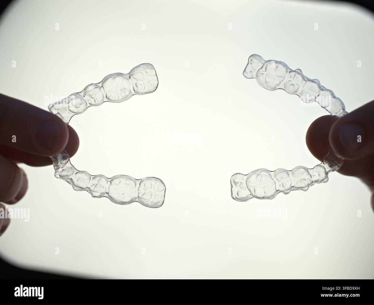 Allineatori dentali trasparenti tenuti in mano per il trattamento ortodontico. Foto Stock