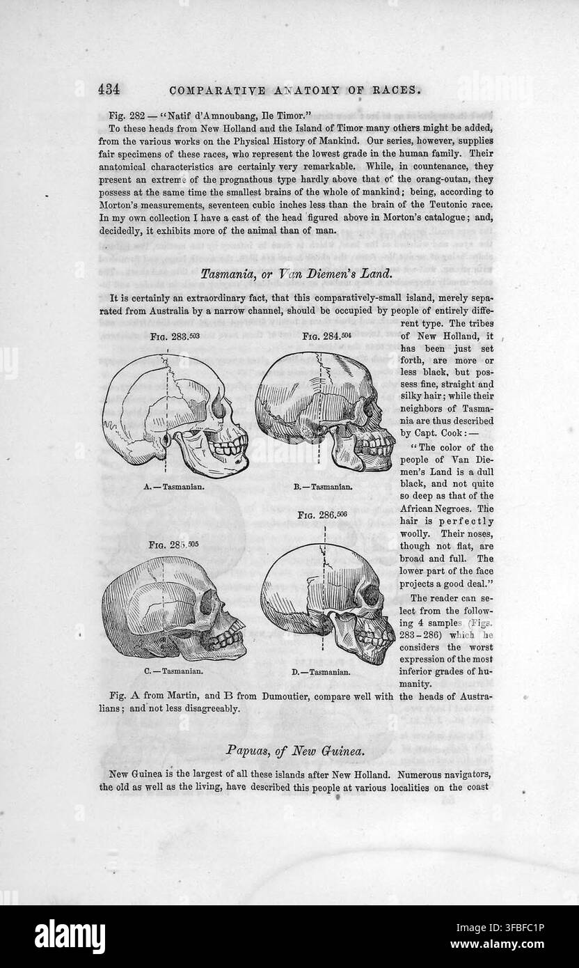 Una pagina di un libro sull'anatomia comparata, pubblicato nel 1854, che discute le caratteristiche fisiche di diverse razze umane, con una figura etichettata "Natif d'Amnoubang, Ile Timor". Foto Stock