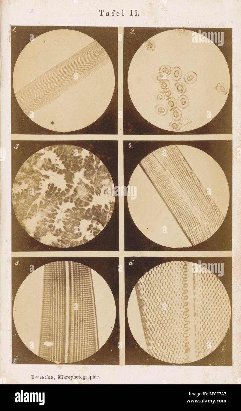 Sei ingrandimenti microscopici di parti del corpo umano, fotografia, pagina, numero: '1., 6.', numero: 'Tabella II.', fotografo: Berthold Benecke, c. 1858 - nel o prima del 1868, carta, stampa all'albumina, altezza 176 mm x larghezza 116 mm, muscoli, altri dettagli anatomici, circolazione sanguigna., Una pagina verticale rettangolare divisa in tre file e due colonne di immagini scientifiche circolari separate da bordi scuri, che mostrano una varietà di texture e motivi ingranditi. Nel cerchio in alto a sinistra una banda diagonale con sottili striature parallele attraversa uno sfondo chiaro. Il cerchio in alto a destra contiene un gruppo di Foto Stock