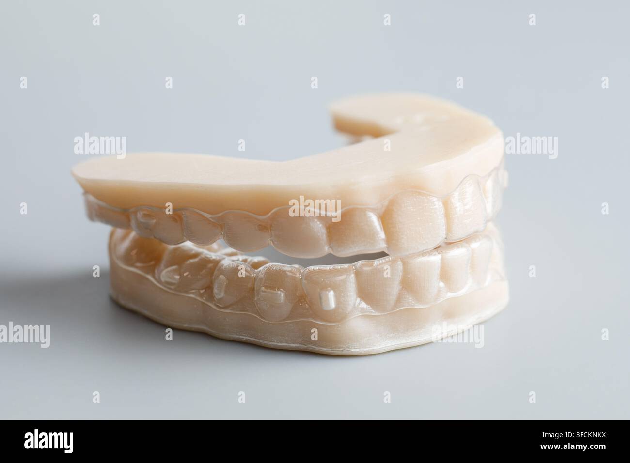Apparecchi dentali allineatori e modello della mascella stampati in 3D Foto Stock