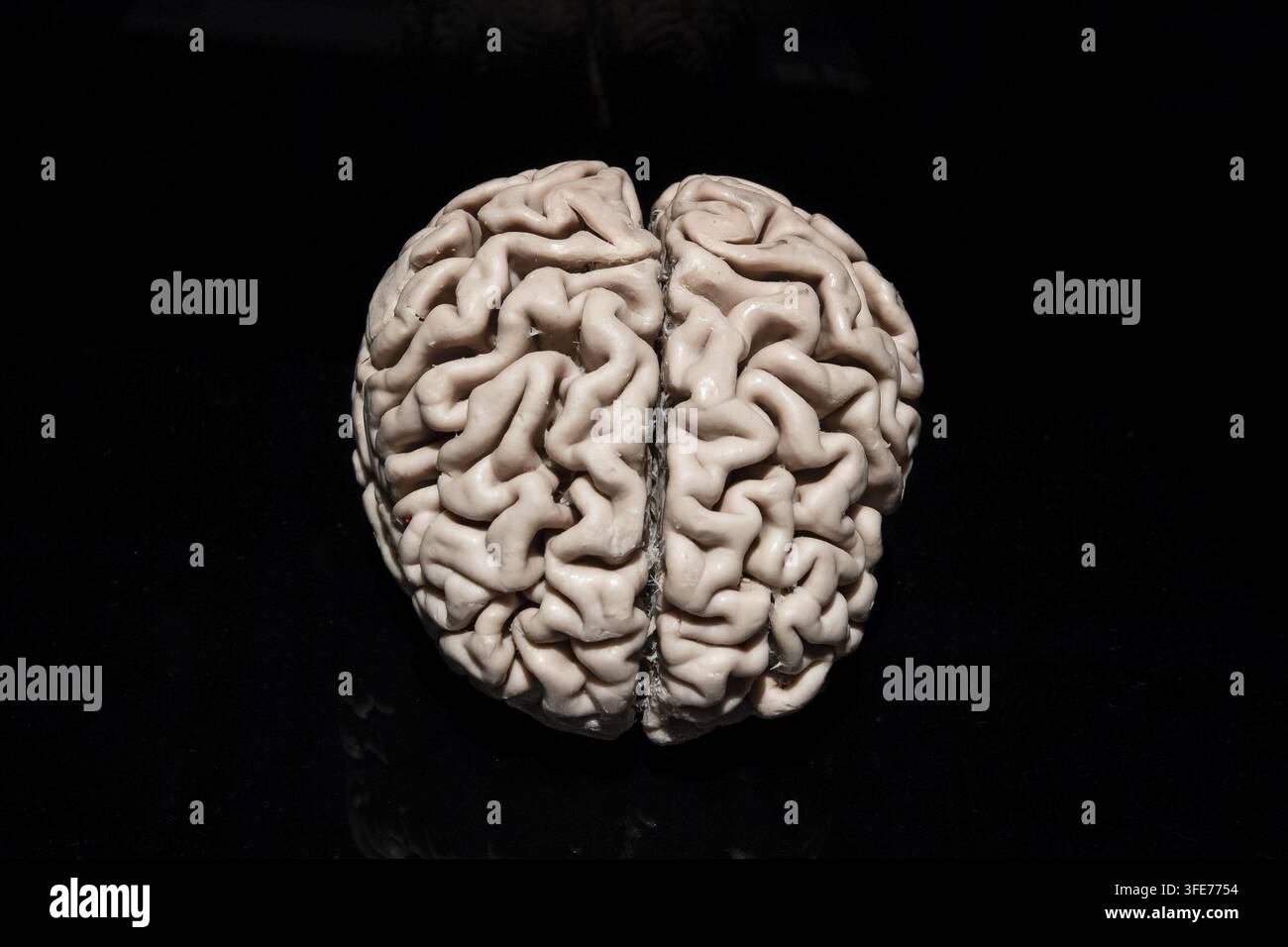 Plastinato, preparazione, corpo mondo, cervello di una persona con morbo di Alzheimer, solchi molto allargati delle circonvoluzioni cerebrali, persone, museo, Gunter Foto Stock