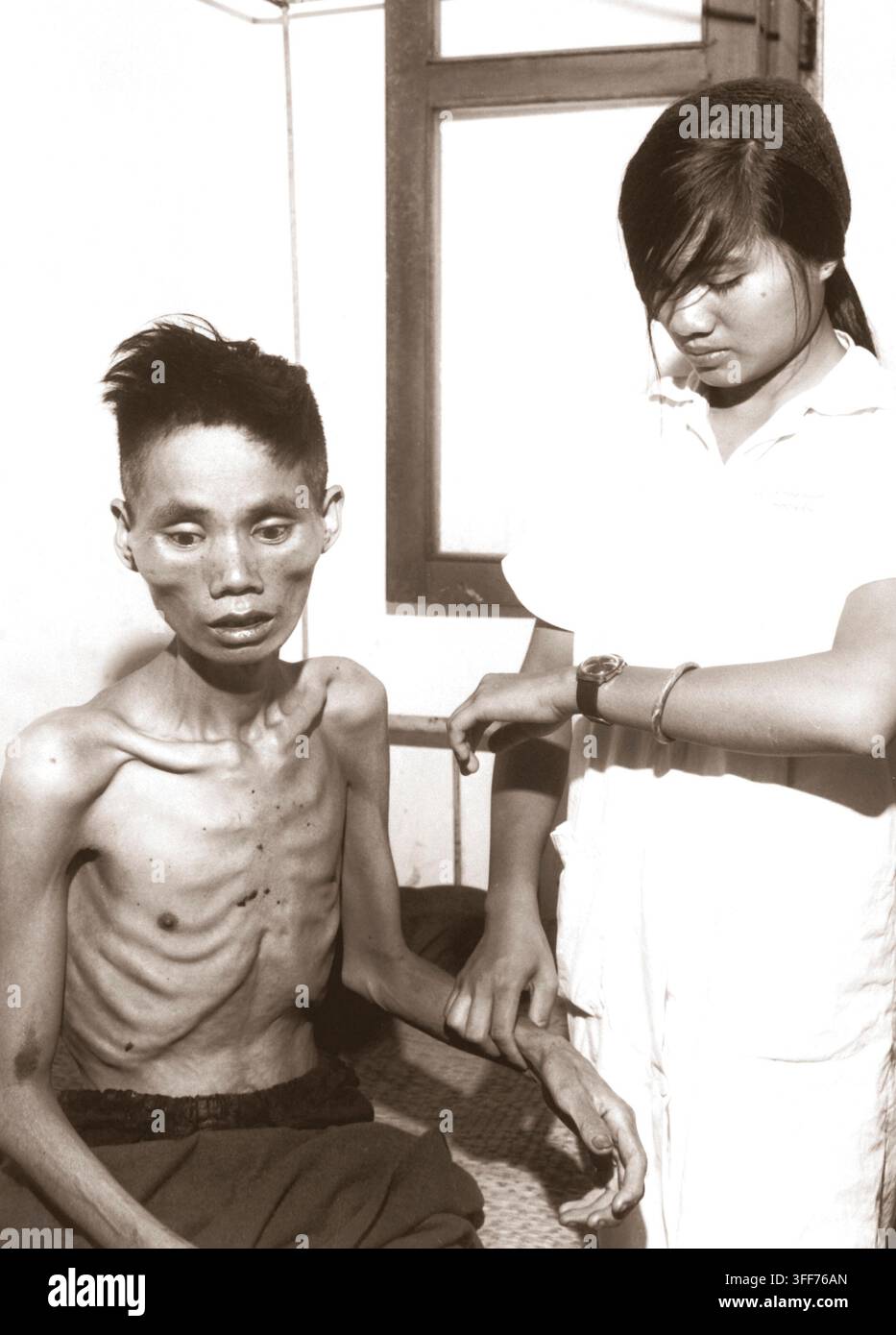 Gli effetti di un solo mese trascorso in un Viet Cong campo di prigionia visualizza il 23-anno-vecchio Le Van a chi aveva difettato da forze comuniste e unite al lato del Governo, è stato ripreso dai Viet Cong e deliberatamente di fame. Ca. 1966. (USIA) DATA ESATTA SHOT NARA SCONOSCIUTO FILE #: 306-PSC-66-3211 guerra & conflitto prenota #: 413 Foto Stock