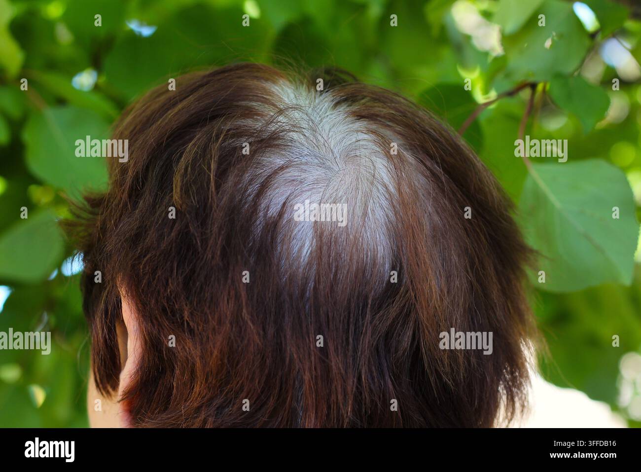 Vista ad angolo alto di una donna con radici grigie e una corona diradata Foto Stock